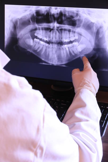 Best Emergency Dental Care for Broken or Chipped Teeth in Pine Beach, NJ