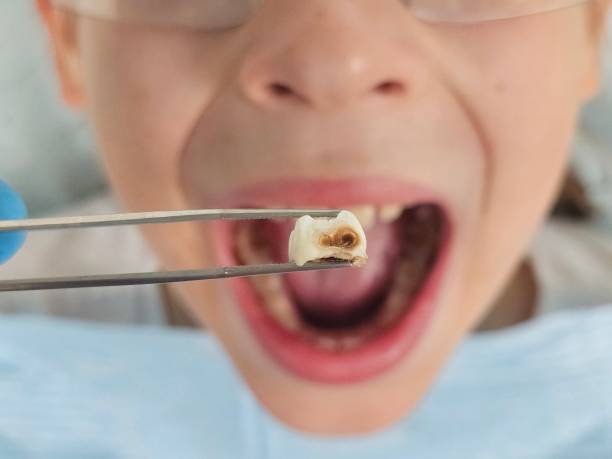Best Emergency Gum Treatment in Pine Beach, NJ